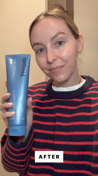 Kinonen after applying the Prequel Barrier Therapy Skin Protectant Cream